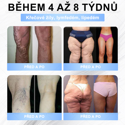 🔥 Extra 30% sleva + zdarma rychlé doručení! 💚 Až 12–25 kg zhubnutí za 4–8 týdnů – přírodní, bezpečné a klinicky testované! ✅ 180denní záruka vrácení peněz – bez rizika!